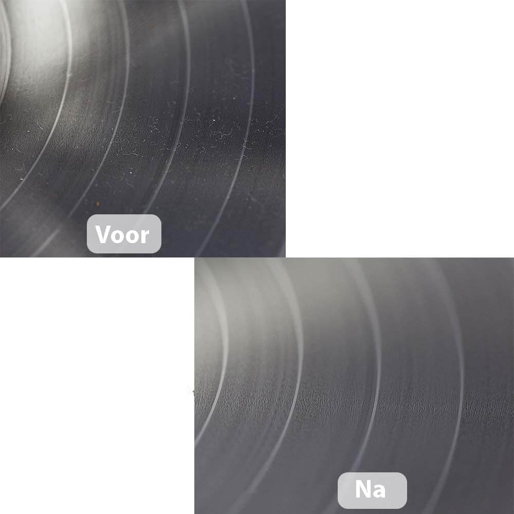 Vicon Vinyl Platenborstelset: 6-in-1 - Inclusief Naaldreiniger - Antistatisch - De Gatgetwinkel